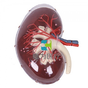 “康為醫(yī)療”透明腎臟放大模型