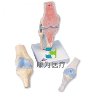 膝關節(jié)截面模型，3部分